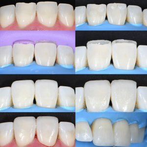 Estetica denta3